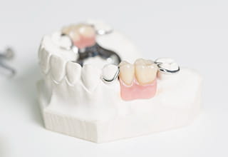通常の部分入れ歯